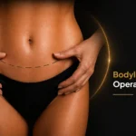 Bodylift-Operationen Informationsbild