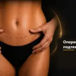 Подтяжка тела — информационное изображение