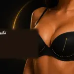 تكبير الثدي — صورة توضيحية