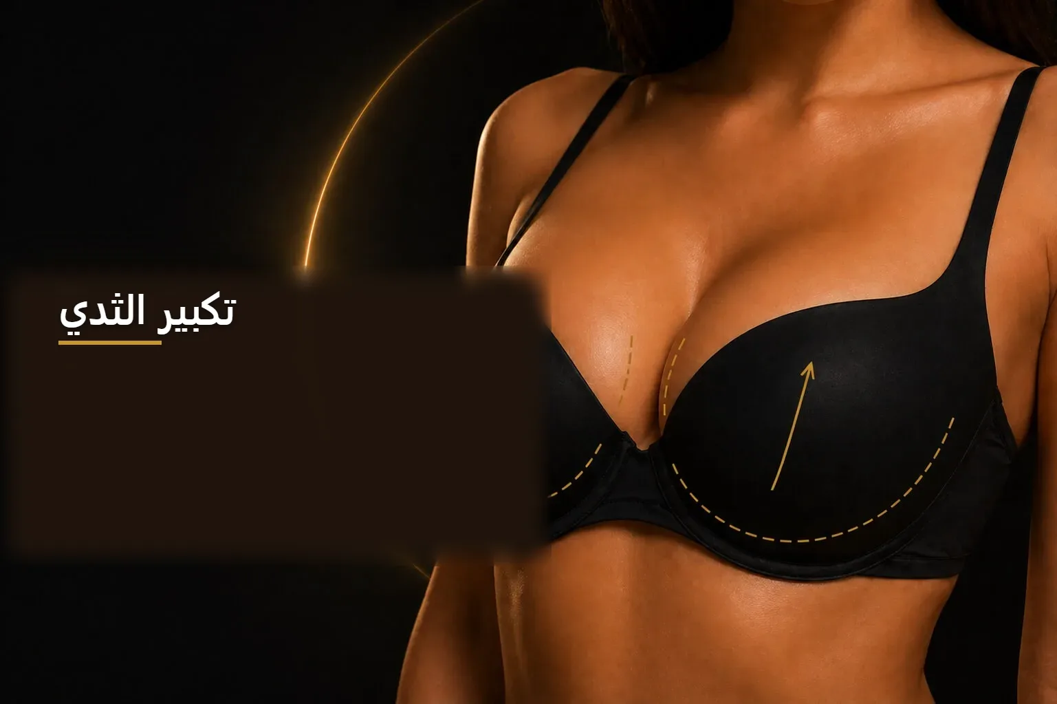 تكبير الثدي — صورة توضيحية