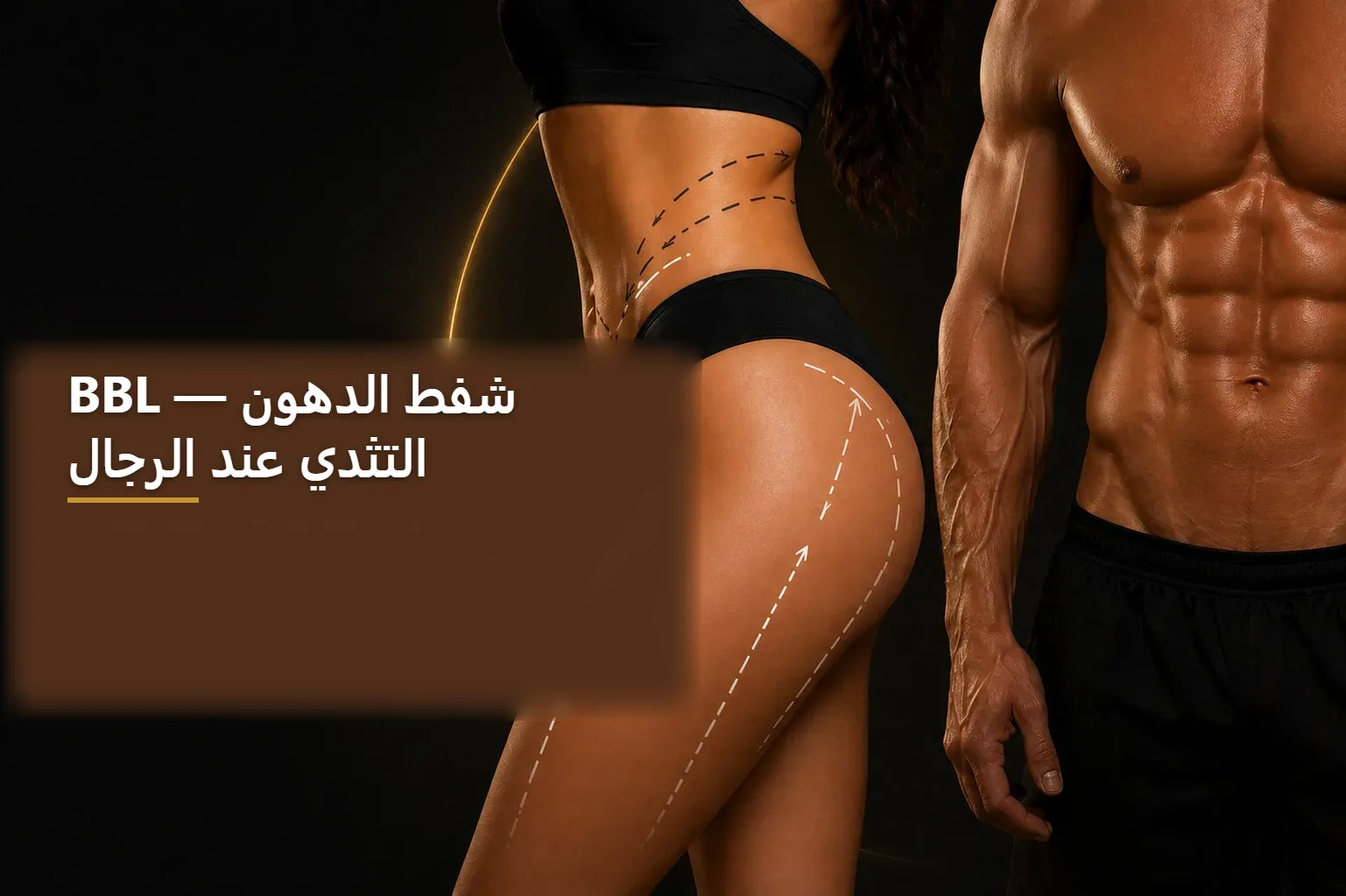 شفط الدهون وBBL — صورة توضيحية