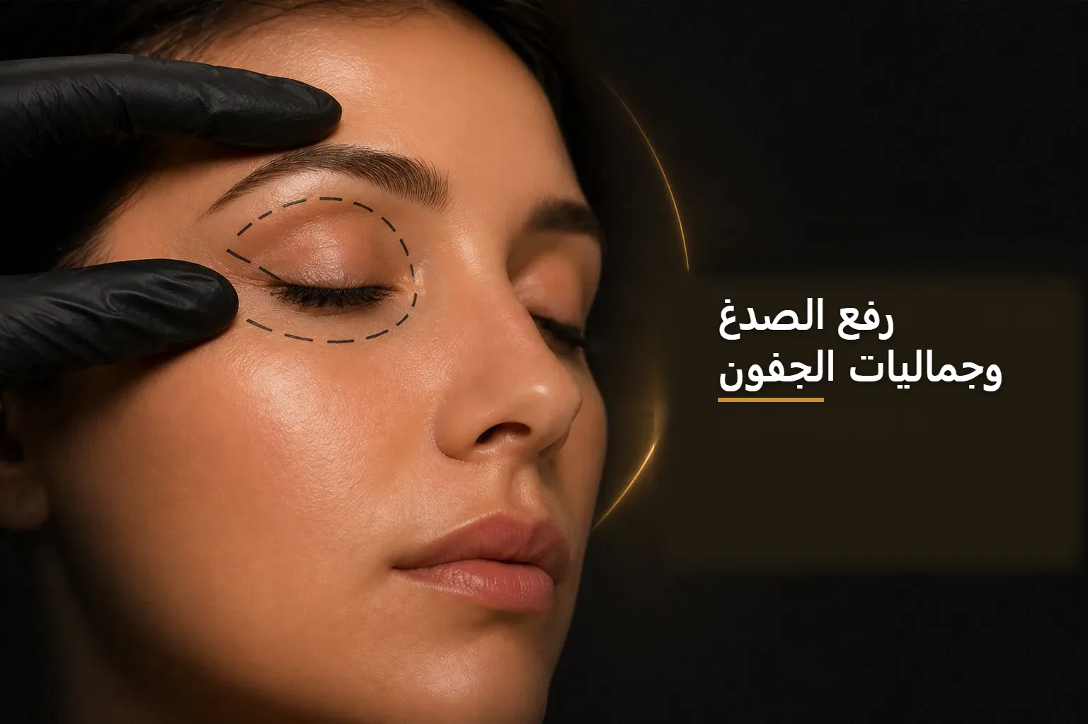 رفع الصدغ وجراحة الجفون — صورة توضيحية